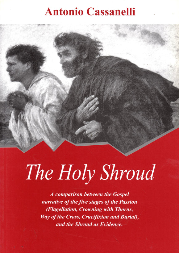 The Holy Shroud: A Comparison Between the Gospel Narrative of the Five Stages of the Passion (Flagellation, Crowning with Thorns, Way of the Cross, Crucifixion and Burial) and the Shroud as Evidence